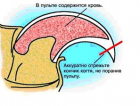Коготь в разрезе
